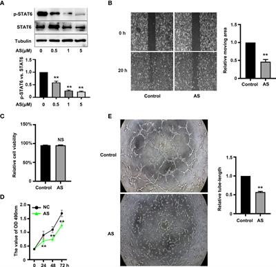 STAT6 Upregulates NRP1 Expression in Endothelial Cells and Promotes Angiogenesis